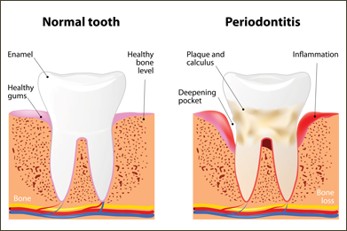 periodontal treatment pendleton oregon